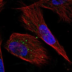 GFPT2 Antibody, Novus Biologicals 0.1 mL | Buy Online | Novus Biologicals | Fisher Scientific